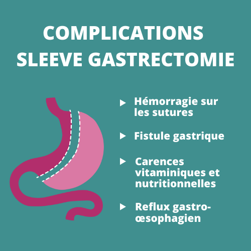 alimentation apres sleeve