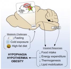 stress obesite